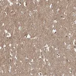 Merck Anti-EPHX4 antibody produced in rabbit