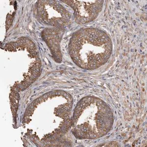 Merck Anti-STEAP2 antibody produced in rabbit
