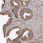 Merck Anti-STEAP2 antibody produced in rabbit
