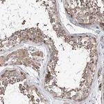 Merck Anti-CEP85L antibody produced in rabbit