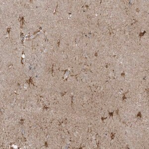 Merck Anti-ZNF263 antibody produced in rabbit