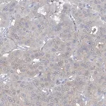 Merck Anti-TRMT2B antibody produced in rabbit