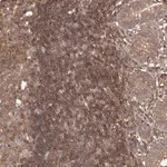 Merck Anti-NFKBIA antibody produced in rabbit