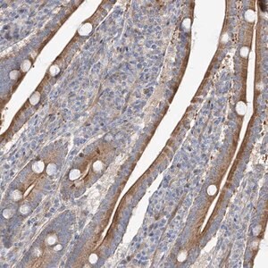 Merck Anti-ZNF641 antibody produced in rabbit