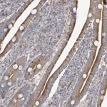 Merck Anti-ZNF641 antibody produced in rabbit