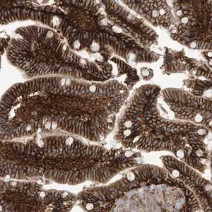 Merck Anti-FSD1L antibody produced in rabbit