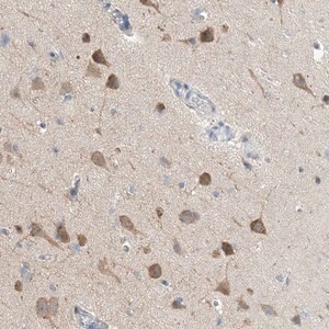 Merck Anti-CCDC14 antibody produced in rabbit