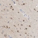 Merck Anti-CCDC14 antibody produced in rabbit