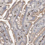 Merck Anti-SLC5A11 antibody produced in rabbit
