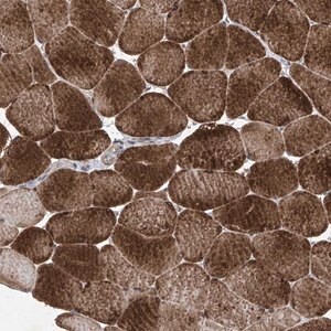 Merck Anti-KIFC2 antibody produced in rabbit