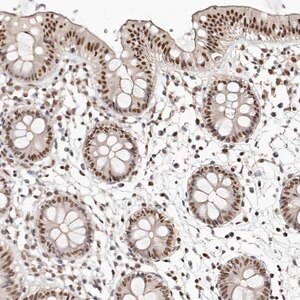 Merck Anti-GLTSCR1L antibody produced in rabbit
