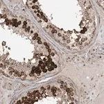 Merck Anti-CETN3 antibody produced in rabbit