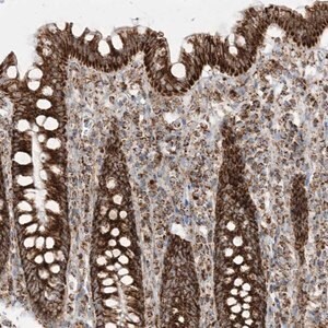Merck Anti-MRPS36 antibody produced in rabbit