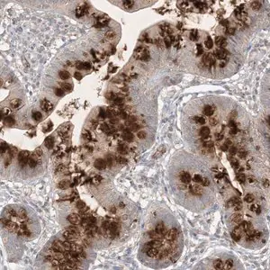 Merck Anti-PRSS36 antibody produced in rabbit