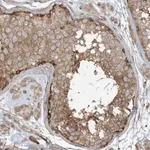 Merck Anti-ATP23 antibody produced in rabbit