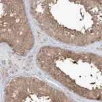 Merck Anti-PPAT antibody produced in rabbit