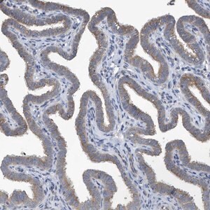 Merck Anti-PPM1M antibody produced in rabbit