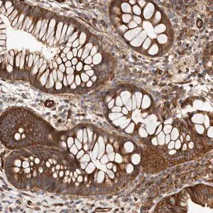 Merck Anti-TMC7 antibody produced in rabbit