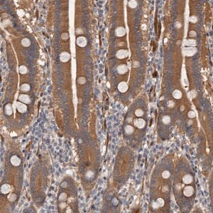 Merck Anti-ARHGEF5 antibody produced in rabbit