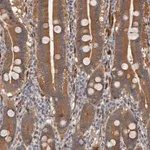 Merck Anti-ARHGEF5 antibody produced in rabbit