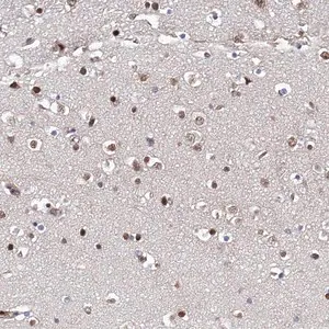 Merck Anti-ZNF655 antibody produced in rabbit