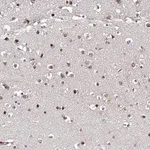 Merck Anti-ZNF655 antibody produced in rabbit