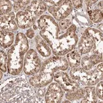 Merck Anti-MACC1 antibody produced in rabbit