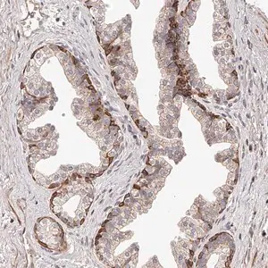 Merck Anti-ZNF502 antibody produced in rabbit