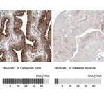 Merck Anti-HGSNAT antibody produced in rabbit