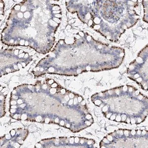 Merck Anti-PSPH antibody produced in rabbit