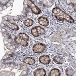 Merck Anti-USP45 antibody produced in rabbit