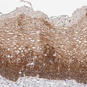 Merck Anti-VIPAS39 antibody produced in rabbit