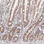 Merck Anti-VIPAS39 antibody produced in rabbit