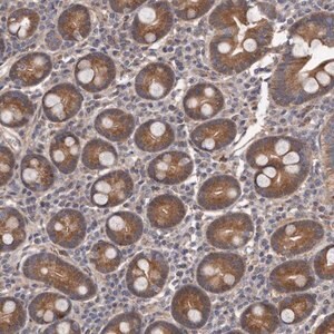 Merck Anti-ARMCX1 antibody produced in rabbit