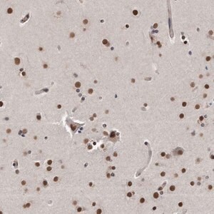 Merck Anti-TP53INP1 antibody produced in rabbit