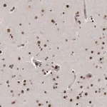 Merck Anti-TP53INP1 antibody produced in rabbit