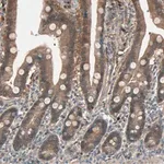 Merck Anti-SDSL antibody produced in rabbit