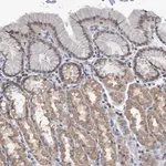 Merck Anti-TSTD1 antibody produced in rabbit