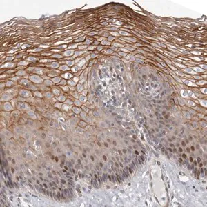 Merck Anti-EPHX3 antibody produced in rabbit