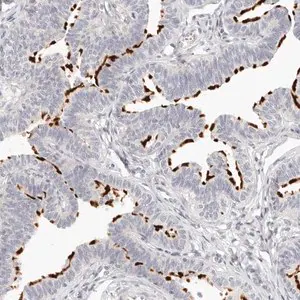 Merck Anti-LTB4R2 antibody produced in rabbit