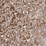 Merck Anti-PDSS2 antibody produced in rabbit