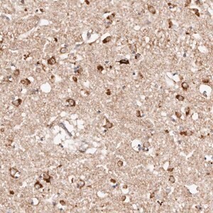 Merck Anti-BCL2L15 antibody produced in rabbit