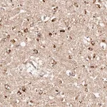 Merck Anti-BCL2L15 antibody produced in rabbit