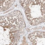 Merck Anti-C6orf118 antibody produced in rabbit