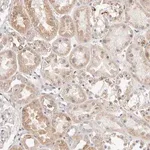 Merck Anti-MYOM3 antibody produced in rabbit