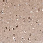 Merck Anti-PRKACB antibody produced in rabbit