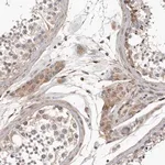 Merck Anti-RNF157 antibody produced in rabbit