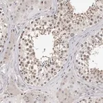 Merck Anti-KIF2B antibody produced in rabbit