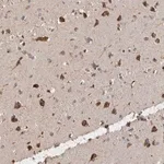 Merck Anti-ANKFY1 antibody produced in rabbit