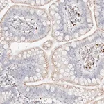 Merck Anti-STKLD1 antibody produced in rabbit